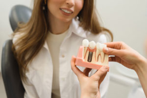 Dental Patient Being Shown A Dental Implant Model During A Consultation